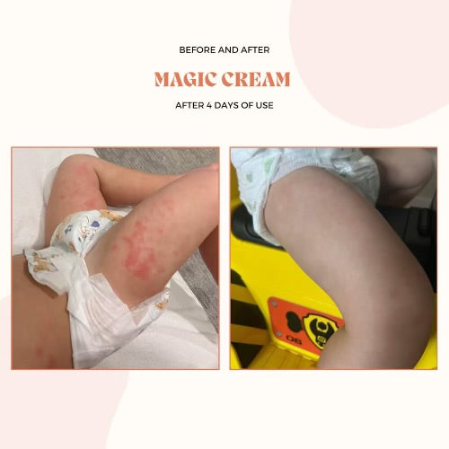 Magic Cream - 3.4 oz